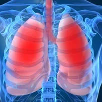 Salford uses Graphnet for drug trial