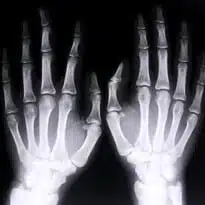 US patients share images