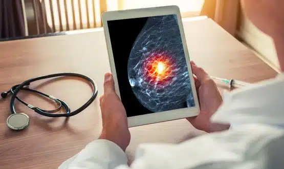 New DeepMind AI ‘spots breast cancer better than clinicians’