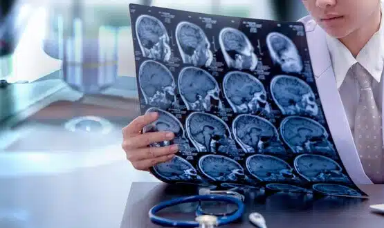 Re:Cognition Health opens concussion clinic featuring brain-scanning tech