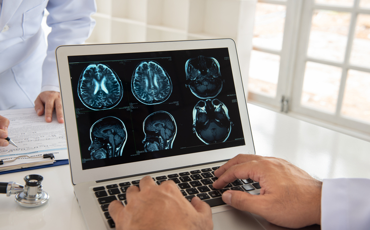 Doctor,Check,Up,X-ray,Film,Of,The,Brain,By,Ct
