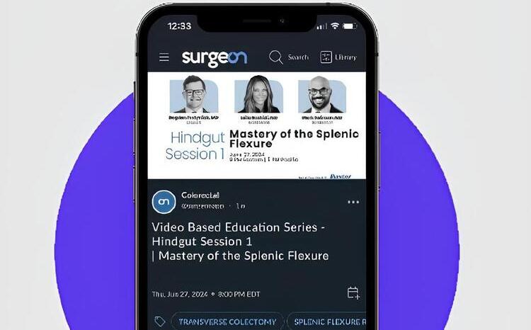 SurgeOn app