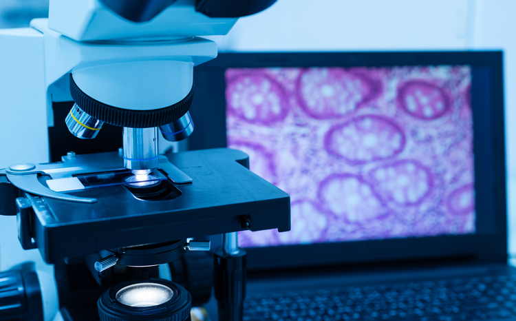 Deciphex raises £26m to expand pathology access